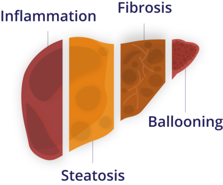 RUO Liver